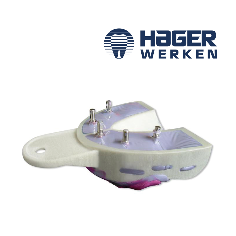 Porte-empreintes Miratray Implant - HAGER & WERKEN - 6 Pcs